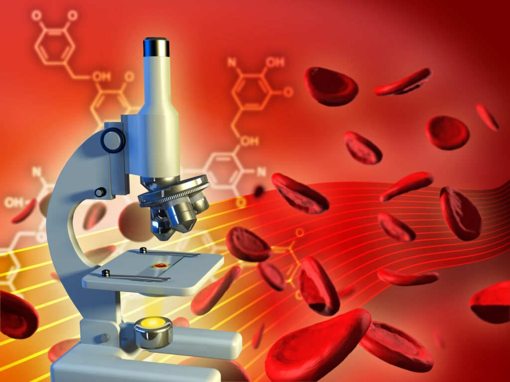 hematology analyzer