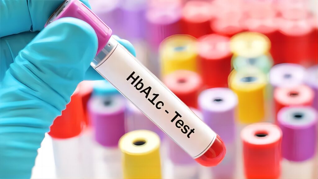 HbA1c Analyzer