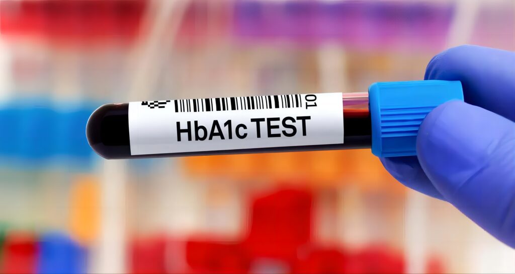 HbA1c analyzer