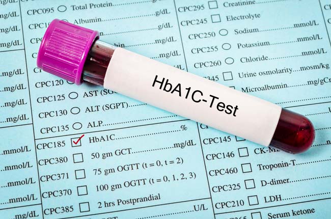 HbA1c analyzer